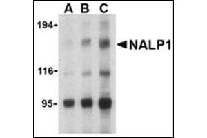 Western blot analysis of NALP1 in U937 cell lysate with this product at (A) 1, (B) 2 and (C) 4 μg/ml. (NLRP1 Antikörper  (C-Term))