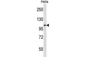 ZFPM2 Antibody (C-term) western blot analysis in Hela cell line lysates (35 µg/lane). (ZFPM2 Antikörper  (C-Term))