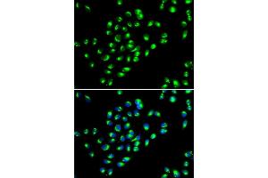 Immunofluorescence analysis of MCF7 cell using GOLM1 antibody.