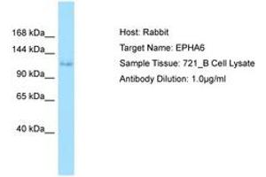 Image no. 1 for anti-EPH Receptor A6 (Epha6) (AA 313-362) antibody (ABIN6749998) (EPH Receptor A6 Antikörper  (AA 313-362))