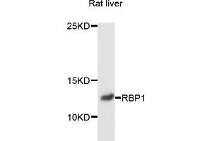 Western blot analysis of extracts of rat liver, using RBP1 antibody (ABIN4904977) at 1:1000 dilution. (RBP1 Antikörper)