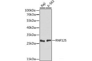 Western blot analysis of extracts of various cell lines using RNF125 Polyclonal Antibody at dilution of 1:1000. (RNF125 Antikörper)