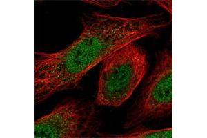 Immunofluorescent staining of human cell line U-2 OS shows positivity in nucleus but not nucleoli. (RPP25 Antikörper)