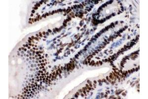 IHC testing of FFPE mouse intestine with TRIM28 antibody. (KAP1 Antikörper  (AA 699-835))