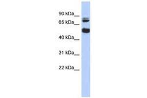 Image no. 1 for anti-Serine/threonine-Protein Kinase NIM1 (NIM1) (AA 143-192) antibody (ABIN6741236) (NIM1 Antikörper  (AA 143-192))