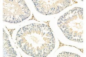 ABIN6264389 and ABIN6279692 at 1/100 staining Rat testis tissue by IHC-P. (PPP1R3D Antikörper  (Internal Region))