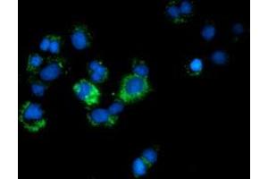 Immunofluorescence (IF) image for anti-Calcium Binding and Coiled-Coil Domain 2 (CALCOCO2) antibody (ABIN1497077) (CALCOCO2 Antikörper)