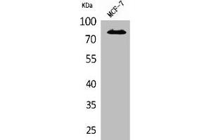 Western Blot analysis of MCF7 cells using IL-1RI Polyclonal Antibody (IL1R1 Antikörper  (N-Term))