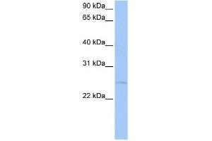 anti-CTA-126B4.3 (N-Term) antibody