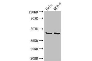 Western Blot Positive WB detected in: Hela whole cell lysate, MCF-7 whole cell lysate All lanes: MAP2K4 antibody at 3. (MAP2K4 Antikörper  (AA 259-398))