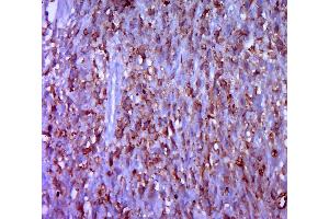 Immunohistochemistry (Paraffin-embedded Sections) (IHC (p)) image for anti-Carcinoembryonic Antigen Gene Family (CEA) antibody (ABIN722946)