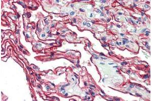 Human Lung (formalin-fixed, paraffin-embedded) stained with S100A10 antibody ABIN462133 followed by biotinylated anti-mouse IgG secondary antibody ABIN481714, alkaline phosphatase-streptavidin and chromogen. (S100A10 Antikörper)