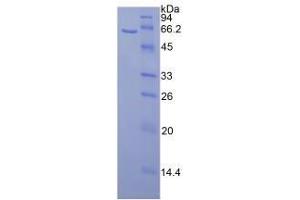 SDS-PAGE analysis of Mouse Calbindin Protein. (CALB1 Protein)