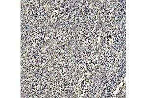 IHC analysis of DCK using anti-DCK antibody (ABIN5693016). (DCK Antikörper  (AA 17-260))