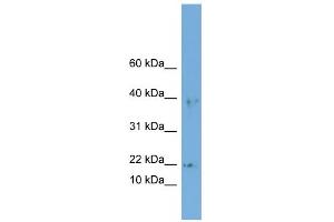 WB Suggested Anti-ARPC3 Antibody Titration: 0. (ARPC3 Antikörper  (Middle Region))