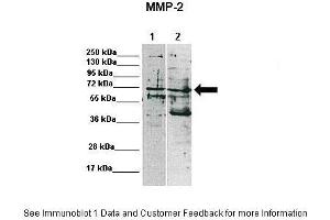 Lanes:   Lane 1: 15ug MDA-MB-231 lysate Lane 2: 15ug MCF7 lysate  Primary Antibody Dilution:    1:1000  Secondary Antibody:   Anti-rabbit-HRP  Secondary Antibody Dilution:    1:10,000  Gene Name:   MMP2  Submitted by:   Katarzyna Augoff, University of Wroclaw (MMP2 Antikörper  (C-Term))