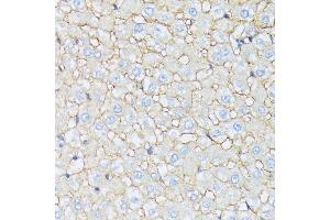 Immunohistochemistry of paraffin-embedded rat liver using CTNN antibody (ABIN7266134) at dilution of 1:100 (40x lens). (CTNNA2 Antikörper  (AA 150-300))