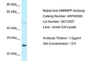 WB Suggested Anti-HNRNPF Antibody   Titration: 1. (HNRNPF Antikörper  (C-Term))