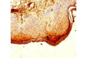 Immunohistochemistry of paraffin-embedded human skin tissue using ABIN7150586 at dilution of 1:100 (ALG12 Antikörper  (AA 367-422))