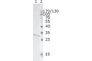 Western Blot testing of HIV-1 recombinant Nef protein. (HIV-1 Nef (AA 31-35) Antikörper)