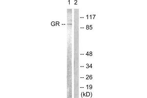 Western Blotting (WB) image for anti-GR (Internal Region), (pSer234), (Ser226), (Ser246) antibody (ABIN1847938) (GR (Internal Region), (pSer234), (Ser226), (Ser246) Antikörper)