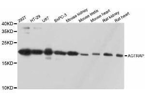 Western blot analysis of extracts of various cell lines, using AGTRAP antibody.