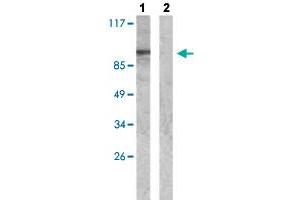 Western blot analysis of Lane 1: Insulin (0. (WASF1 Antikörper  (pTyr125))
