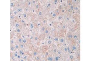 Used in DAB staining on fromalin fixed paraffin- embedded liver tissue (TSTA3 Antikörper  (AA 1-321))