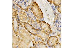 Immunohistochemistry of paraffin-embedded mouse kidney using CDC42 antibody at dilution of 1:200 (x400 lens) (CDC42 Antikörper  (AA 25-191))