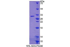 Image no. 1 for ATP-Binding Cassette, Sub-Family D (Ald), Member 4 (ABCD4) (AA 356-606) protein (T7 tag,His tag) (ABIN6239311) (ABCD4 Protein (AA 356-606) (T7 tag,His tag))