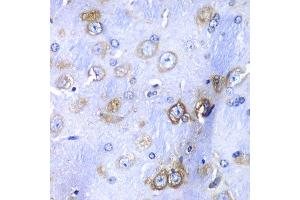 Immunohistochemistry (Paraffin-embedded Sections) (IHC (p)) image for anti-Ribosomal Protein S3A (RPS3A) (AA 1-264) antibody (ABIN6147221)