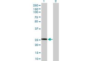 Western Blot analysis of GSTO2 expression in transfected 293T cell line by GSTO2 MaxPab polyclonal antibody.