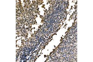 IHC analysis of WAPL/FOE using anti-WAPL/FOE antibody (ABIN7602663). (WAPAL Antikörper  (AA 916-1190))