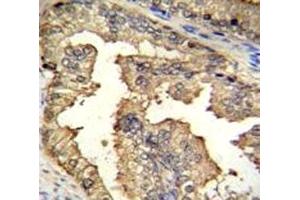 Immunohistochemistry (IHC) image for anti-Coactivator-Associated Arginine Methyltransferase 1 (CARM1) (AA 346-377) antibody (ABIN3030540)