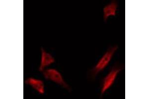 Immunofluorescence (fixed cells) (IF/ICC) image for anti-Heat Shock 70kDa Protein 9 (Mortalin) (HSPA9) antibody (ABIN6262097)