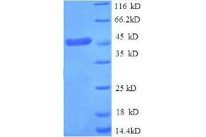 SDS-PAGE (SDS) image for Tumor Necrosis Factor Receptor Superfamily Member 1A (TNR1A) (AA 31-210) protein (GST tag) (ABIN5712514)