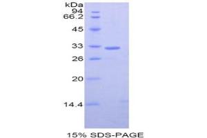 SDS-PAGE analysis of Mouse GRAP2 Protein. (GRAP2 Protein)