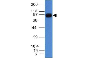 Western Blot of A431 cell lysate using Nucleolin Mouse Monoclonal Antibody (NCL/902). (Nucleolin Antikörper)
