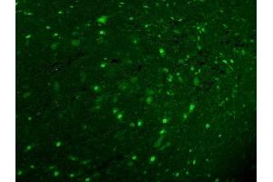 IF analysis of Calbindin using anti-Calbindin antibody (ABIN6719541). (CALB1 Antikörper  (AA 2-261))