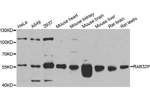Western blot analysis of extracts of various cell lines, using RAB3IP antibody. (RAB3IP Antikörper)
