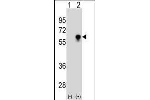 Western blot analysis of CDC25C (arrow) using CDC25C Antibody (ABIN1539792 and ABIN2843765). (CDC25C Antikörper)