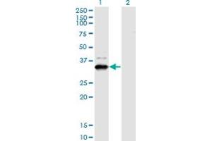 Western Blot analysis of ZNF365 expression in transfected 293T cell line by ZNF365 monoclonal antibody (M03), clone 2E3. (ZNF365 Antikörper  (AA 147-219))