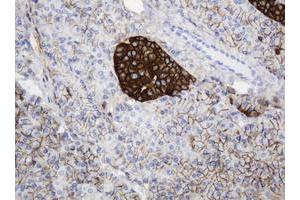 Image no. 1 for anti-CD99 (CD99) antibody (ABIN1497383) (CD99 Antikörper)