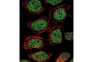 Fluorescent confocal image of Hela cell stained with NR3C1 Antibody (Center) (ABIN651659 and ABIN2840347). (Glucocorticoid Receptor Antikörper  (AA 236-262))