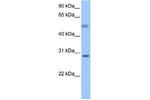 C17ORF81 antibody used at 1 ug/ml to detect target protein. (Retinoic Acid Induced 12 (RAI12) (C-Term) Antikörper)