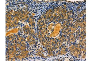 ABIN6261604 and ABIN6266802 at 1/100 staining Rat ovarian tissue by IHC-P. (EPS8-Like 2 Antikörper  (N-Term))