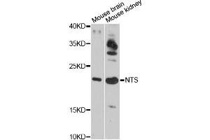 Western blot analysis of extracts of various cell lines, using NTS antibody (ABIN6290694) at 1:3000 dilution. (Neurotensin Antikörper)
