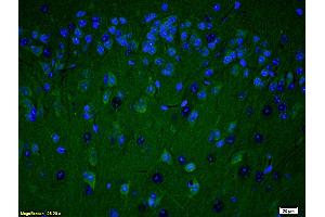 Formalin-fixed and paraffin embedded rat brain labeled with Anti PARP (N-Terminus) Polyclonal Antibody, Unconjugated (ABIN677903) at 1:200 followed by conjugation to the secondary antibody Goat Anti-Rabbit IgG, FITC conjugated used at 1:200 dilution for 40 minutes at 37°C and DAPI (PARP1 Antikörper  (AA 201-300))