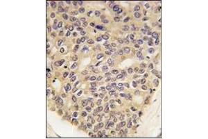 Immunohistochemistry (IHC) image for anti-PTEN Induced Putative Kinase 1 (PINK1) antibody (ABIN356391) (PINK1 Antikörper)