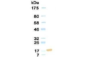 Western Blotting (WB) image for anti-Collagen, Type XVIII, alpha 1 (COL18A1) antibody (ABIN933868) (COL18A1 Antikörper)